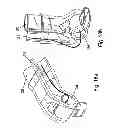 Fig. 13 - Nasal adapter system for CPAP respiration