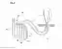 Fig. 04 - Portable intake air sterilizing apparatus