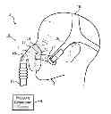 Fig. 01 - PATIENT INTERFACE, CUSHION THEREOF, AND MANUFACTURING METHOD