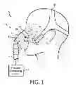 Fig. 02 - PATIENT INTERFACE, CUSHION THEREOF, AND MANUFACTURING METHOD