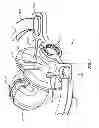 Fig. 02 - Bite block