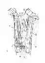 Fig. 02 - ORAL SLEEP APNOEA DEVICE
