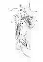 Fig. 03 - ORAL SLEEP APNOEA DEVICE