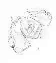Fig. 05 - ORAL SLEEP APNOEA DEVICE