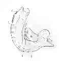 Fig. 06 - ORAL SLEEP APNOEA DEVICE