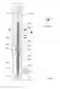 Fig. 08 - Apparatus and method for recovering fluids from a well and/or injecting fluids into a well