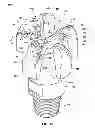 Fig. 11 - Earth-boring tools including movable cutting elements and related methods