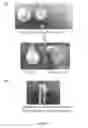 Fig. 06 - Method of building massively-parallel ion concentration polarization separation device