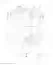 Fig. 02 - DISPOSABLE WEARING ARTICLE AND PACKAGED ASSEMBLY THEREOF
