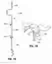 Fig. 08 - Decoy and Camera Stake