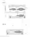 Fig. 12 - Method and device for the production of an injection-moulded part