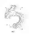 Fig. 06 - Multiple axis hinge arrangement for a truck hood