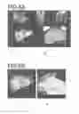 Fig. 08 - Pattern and surgery support set, apparatus, method and program