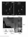 Fig. 04 - HIGH RESOLUTION DUAL-OBJECTIVE MICROSCOPY