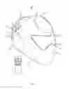 Fig. 02 - PORTABLE AUDIO/ VIDEO MASK