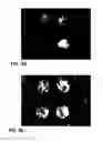 Fig. 09 - System and method for assessing retinal functionality