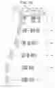 Fig. 11 - Zoom lens system, optical apparatus and method for manufacturing zoom lens system