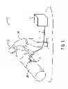 Fig. 02 - Temperature sensor belt