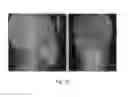 Fig. 03 - X-ray imaging apparatus