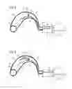 Fig. 04 - Inflatable ear mold with protected inflation air inlet