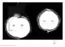 Fig. 01 - Imaging processing apparatus and method for masking an object