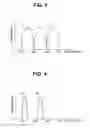 Fig. 04 - Medical image processing device