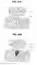 Fig. 37 - Medical image processing device