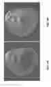 Fig. 07 - Methods and apparatus for scatter correction for CBCT system and cone-beam image reconstruction