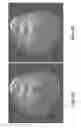 Fig. 08 - Methods and apparatus for scatter correction for CBCT system and cone-beam image reconstruction
