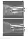 Fig. 09 - Methods and apparatus for scatter correction for CBCT system and cone-beam image reconstruction