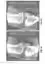 Fig. 22 - Methods and apparatus for scatter correction for CBCT system and cone-beam image reconstruction