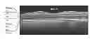 Fig. 01 - Segmentation and identification of layered structures in images