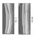 Fig. 06 - Segmentation and identification of layered structures in images