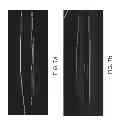 Fig. 07 - Segmentation and identification of layered structures in images
