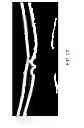 Fig. 22 - Segmentation and identification of layered structures in images