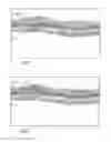Fig. 02 - Method and system for analyzing optical coherence tomography (OCT) results using color reflectivity discretization analysis