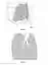 Fig. 05 - Particle image velocimetry suitable for X-ray projection imaging
