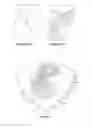 Fig. 06 - Particle image velocimetry suitable for X-ray projection imaging