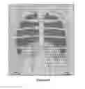 Fig. 08 - Particle image velocimetry suitable for X-ray projection imaging