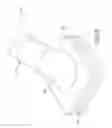 Fig. 20 - Liquid dispensing applicator with radial locking system