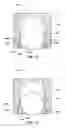 Fig. 09 - Pneumatic reciprocating fluid pump with improved check valve assembly, and related methods