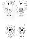 Fig. 09 - Apparatus for disinfecting or sterilizing a catheter and method of use