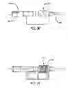Fig. 16 - Apparatus for disinfecting or sterilizing a catheter and method of use