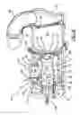 Fig. 23 - Axial flow atomization module