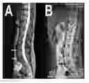 Fig. 01 - Regenerative autologous bone marrow cell therapies and methods for their use in the treatment of joint pain