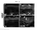 Fig. 09 - Use of EC-SOD and method for preparing thereof