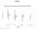 Fig. 10 - METHODS OF TREATMENT AND PREVENTION OF EYE DISEASES