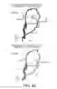 Fig. 50 - ANTIGEN-BINDING MOLECULE FOR PROMOTING ELIMINATION OF ANTIGENS