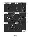 Fig. 09 - Biomaterials and implants for enhanced cartilage formation, and methods for making and using them
