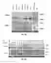 Fig. 04 - Compositions and methods for the diagnosis and therapy of BCL2-associated cancers
